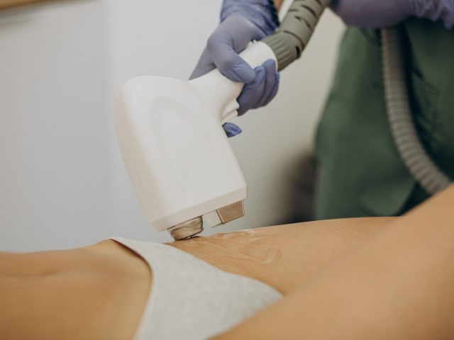 Laser epilation, hair removal therapy